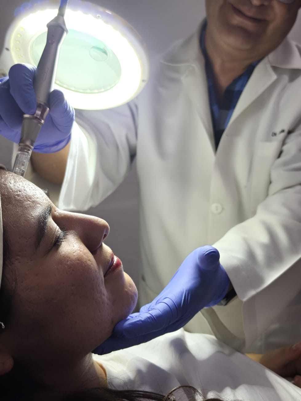 Dermapen aplicado por el Dr. Luis Alberto en Zapopan